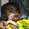 Country logs highest single-day 17 deaths from measles, similar symptoms